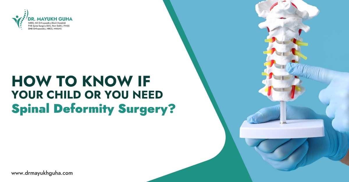 How to know if your child or you need spinal deformity surgery