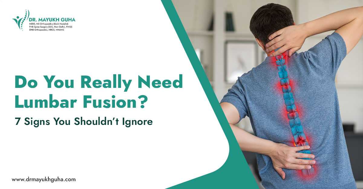 Do You Really Need Lumbar Fusion? 7 Signs You Shouldn&rsquo;t Ignore