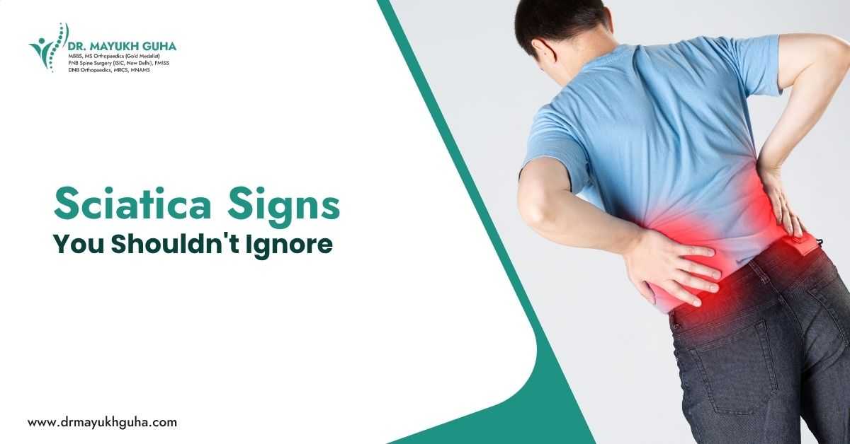 Sciatica Signs You Shouldn't Ignore