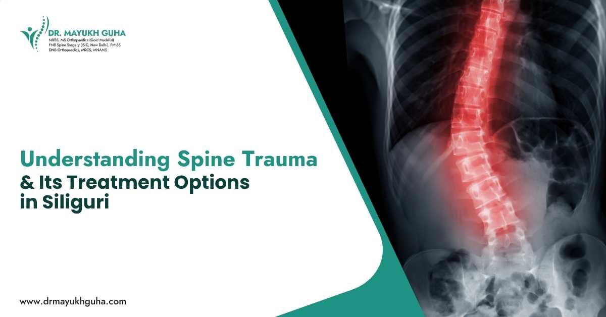 Understanding spine Trauma and its treatment options in Siliguri