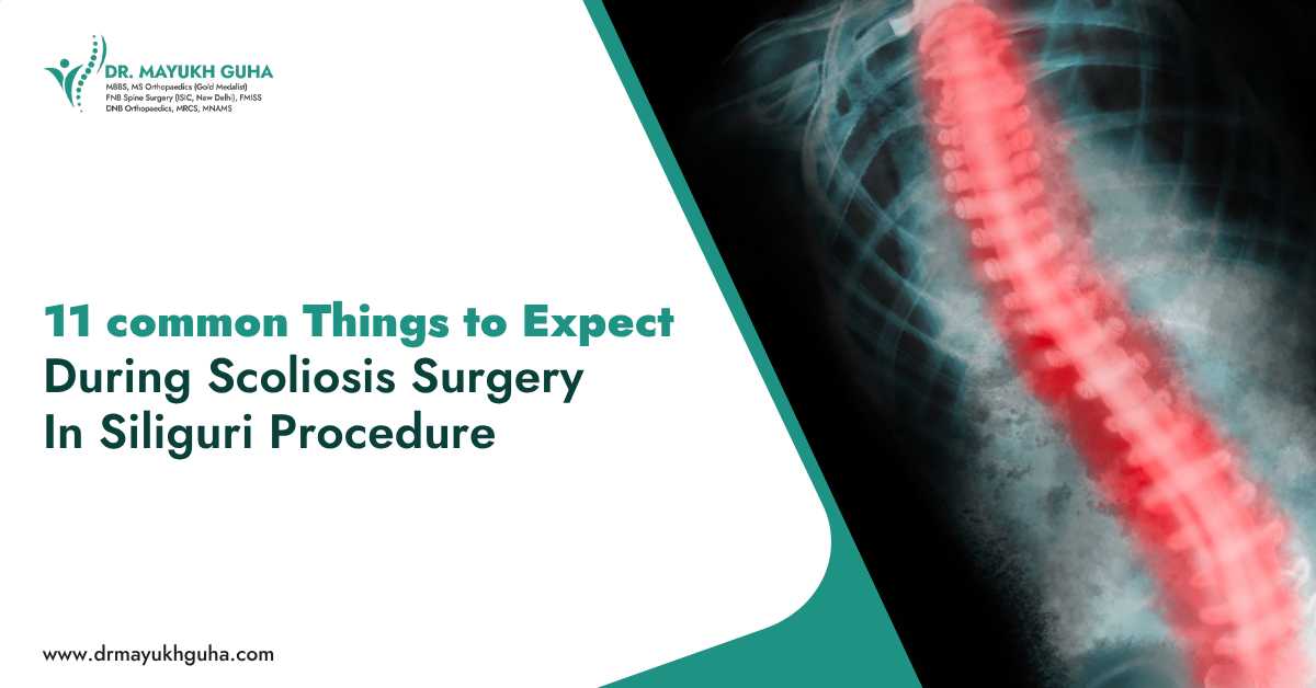 11 Common Things to Expect During Scoliosis Surgery in Siliguri Procedure